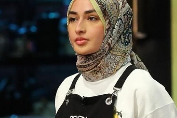 Masterchef’te yüzü yanan Beyza’nın durumunu Şef Somer anlattı!