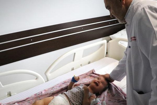 Konjenital nadir hastalık! 2 -Er -Lold Child ‘Peygamberin Sünneti’ teşhis edildi: Yama yanağından alındı, idrar kanalı yapıldı …