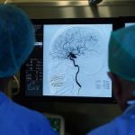 Robotik rehabilitasyon umutları